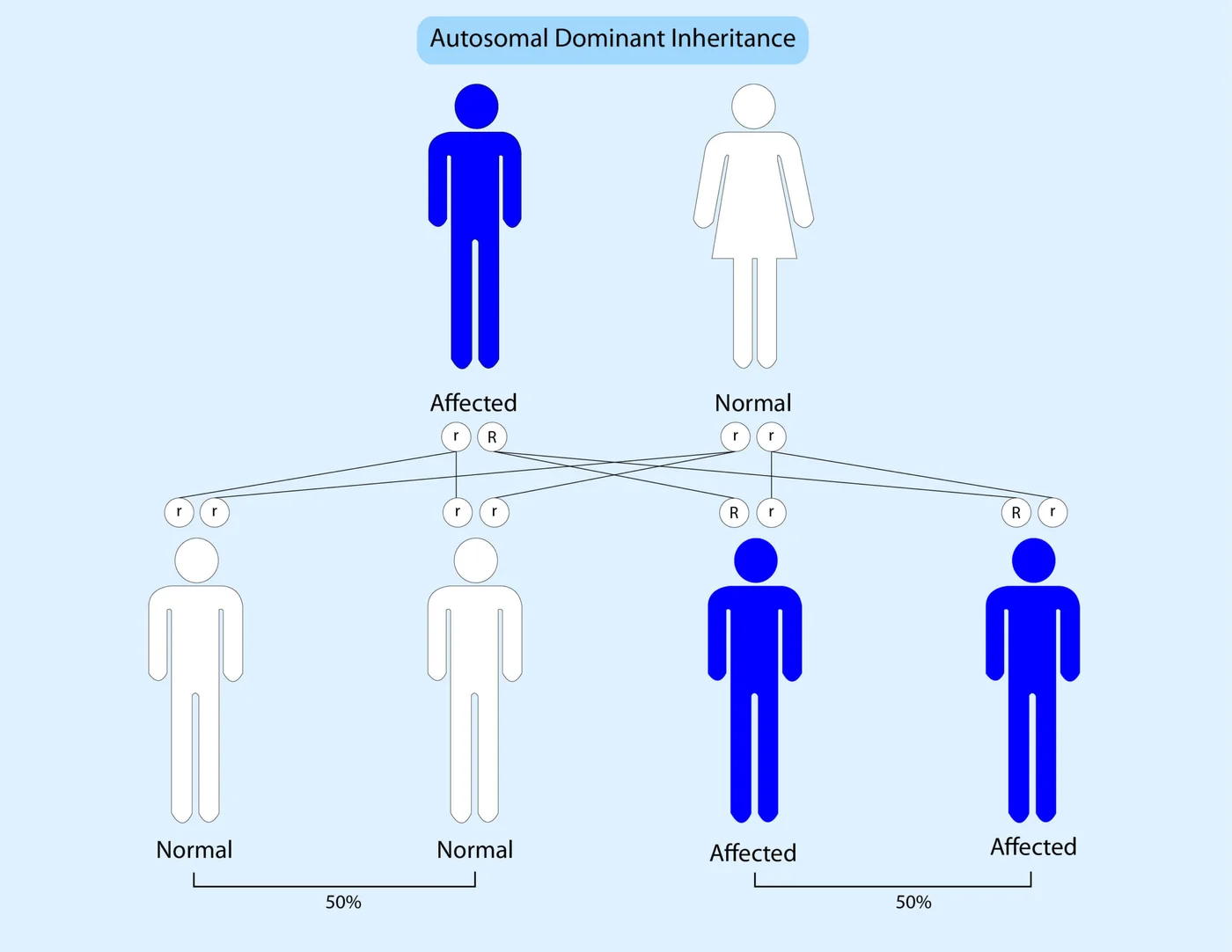 Autosomal dominant inheritance: one affected parent and one unaffected parent, with each child having a 50% chance of being affected.