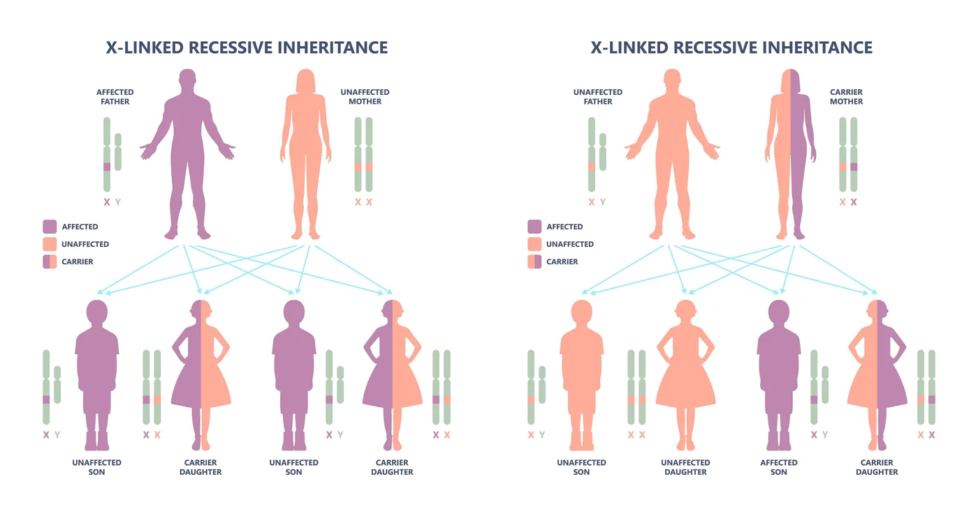 X-linked inheritance: a carrier mother and an unaffected father, showing affected sons and carrier daughters.